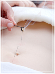 Acupuncture for painful periods