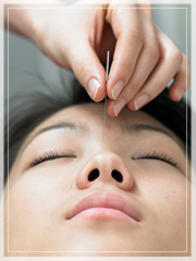 Acupuncture for headache